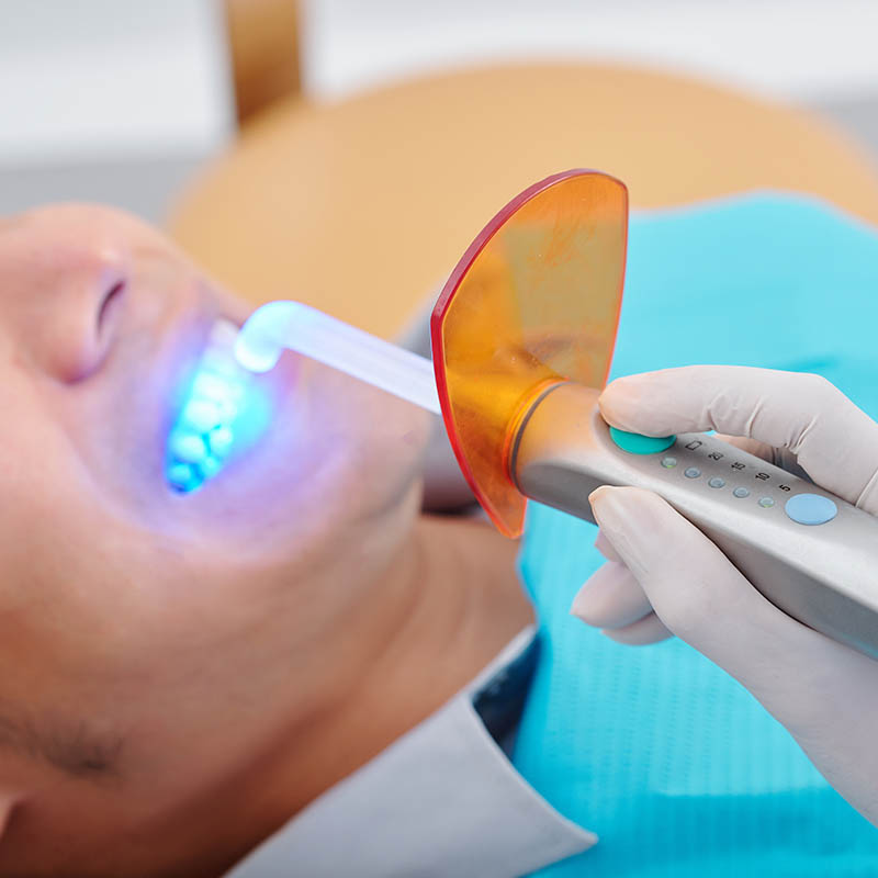 Dentist using modern curing light